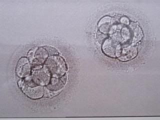  photo IVF2March2013014.jpg